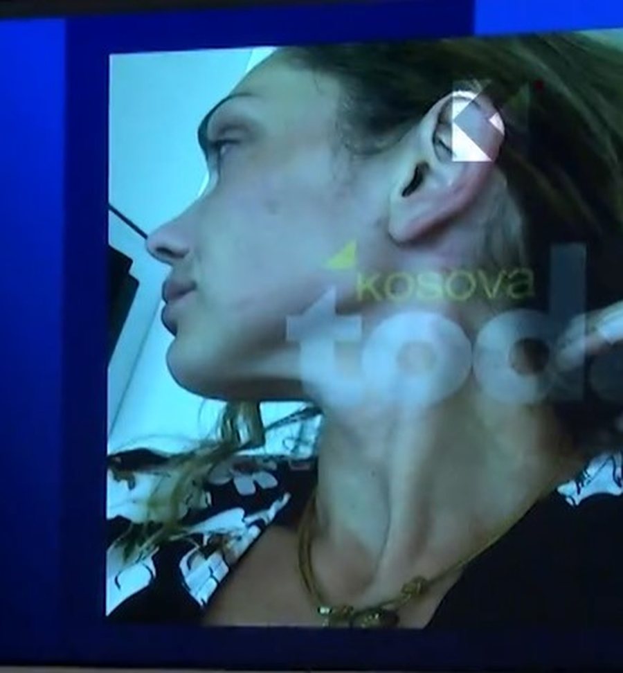 Ish-miss Kosova ndan pamjet e dhunës që thotë se ushtroi