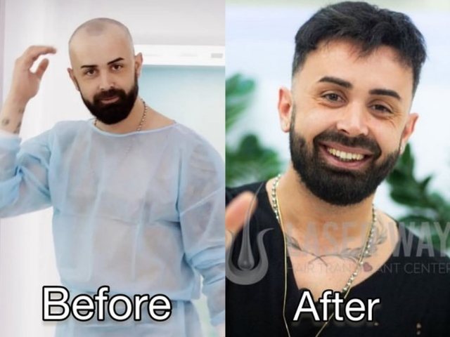 Si dukeshin këto 5 personazhe të njohur shqiptarë para mbjelljes
