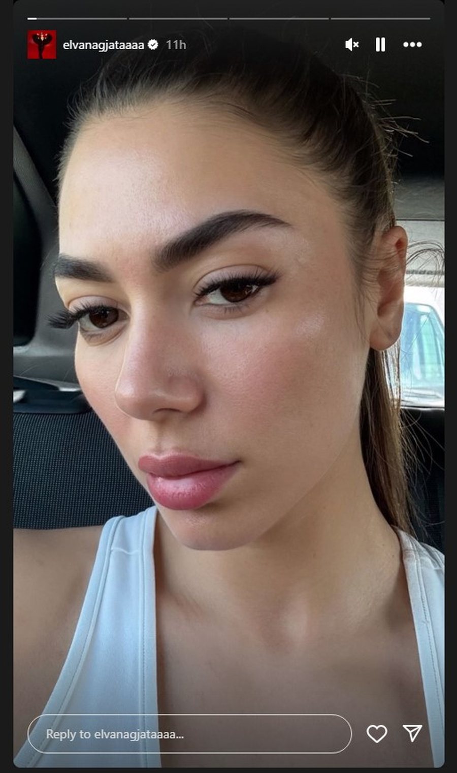 Kështu duket Elvana Gjata pa make up!