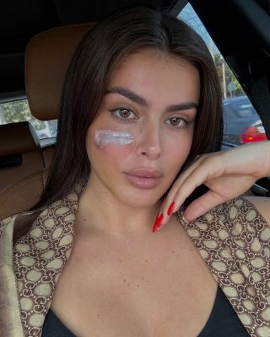 U godit nga motrat Berisha, Klea Prenga nxjerr foton e re: Si duket fytyra e saj