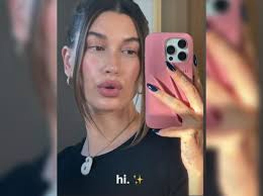 Fotoja që tregon gjendjen e Hailey Bieber pas lindjes!