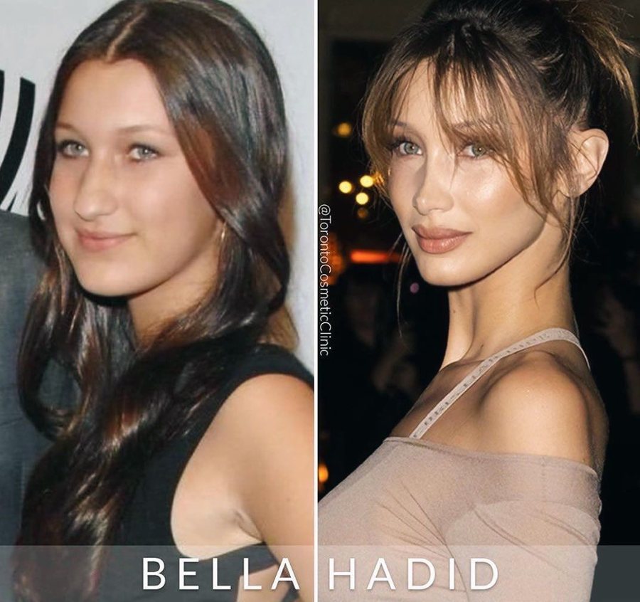 Një nga femrat më të bukura në botë, por Bella Hadid