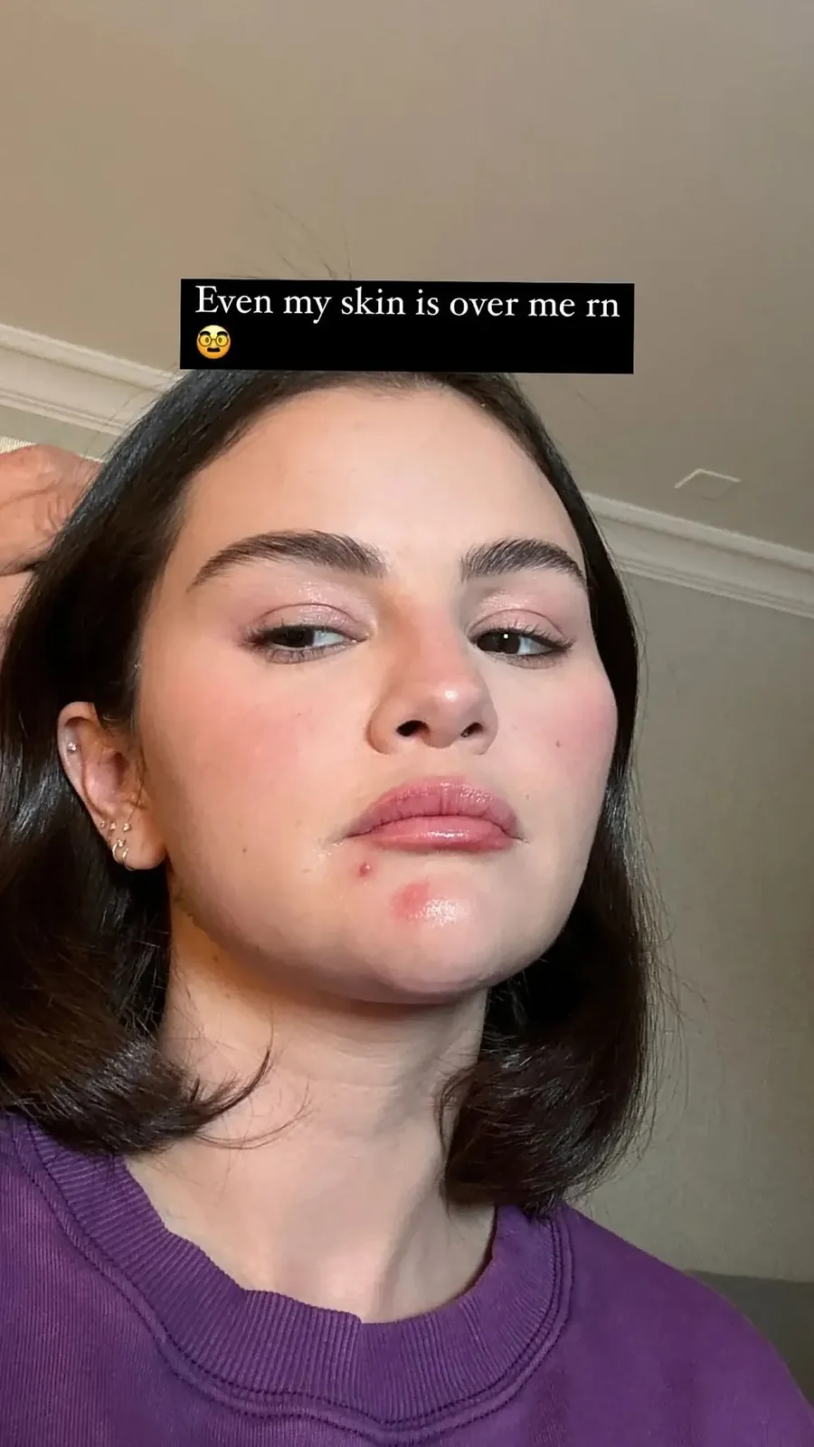 Selena Gomez tregon një tjetër pasiguri të saj!