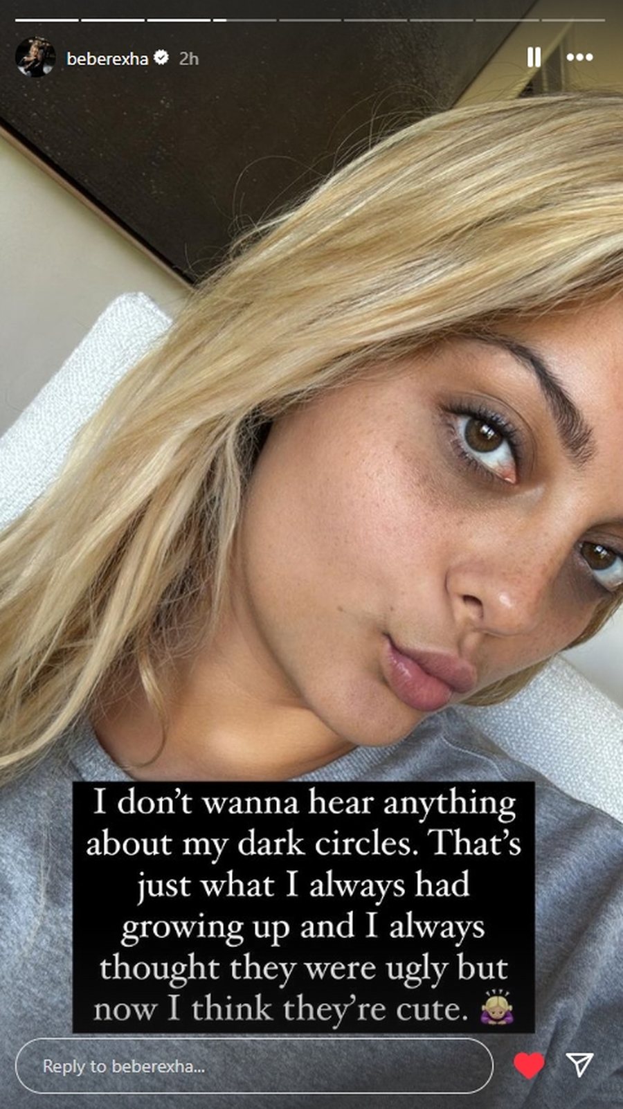 Bebe Rexha shfaqet pa make up: Mos komentoni rrathët e mi të zinj