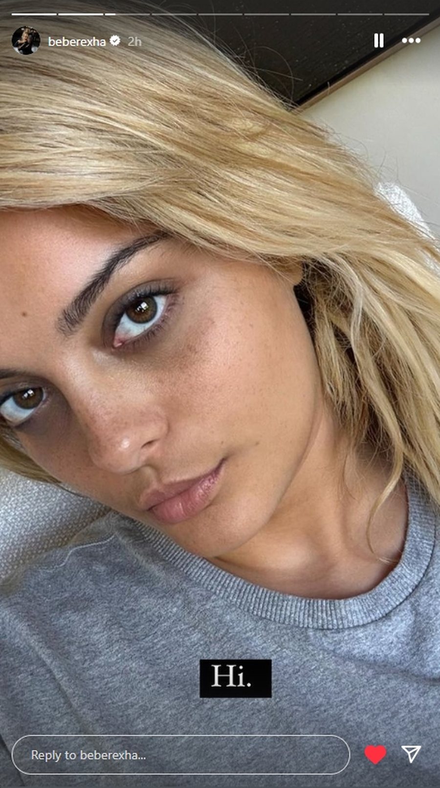 Bebe Rexha shfaqet pa make up: Mos komentoni rrathët e mi të zinj