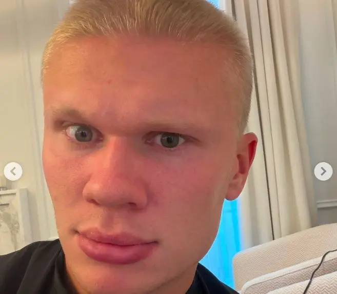 Haaland i thotë lamtumirë flokëve të gjata  shfaqet me pamje të re