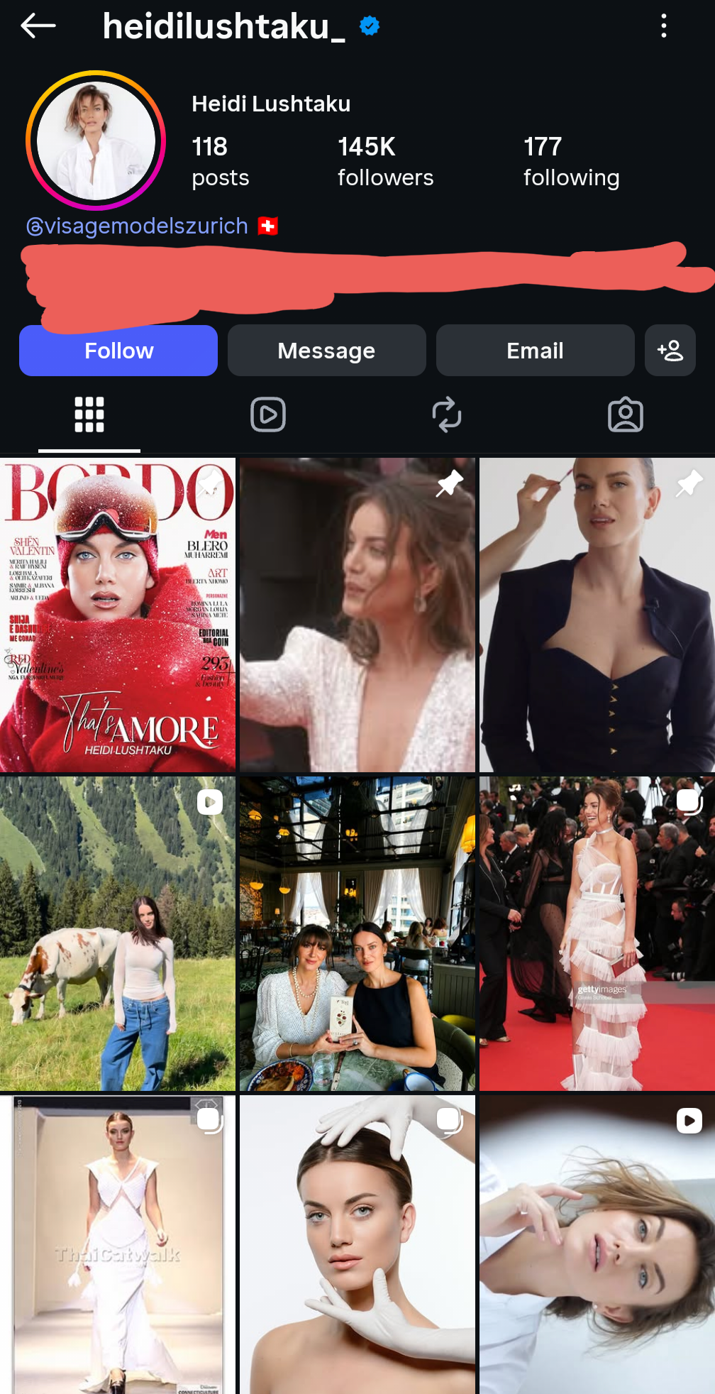 e-papritur-influencerja-shqiprare-ndahet-nga-bashkeshorti-hoqi-mbiemrin-e-tij-nga-rrjetet-sociale-foto
